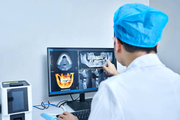 Best Chipped Tooth Repair Near Me  in New Carlisle, OH